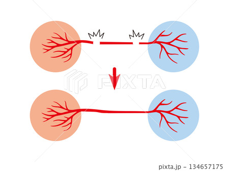 わかりやすい神経再生医療　神経の再生で蘇る神経　自然治癒・自己再生　機能回復 134657175