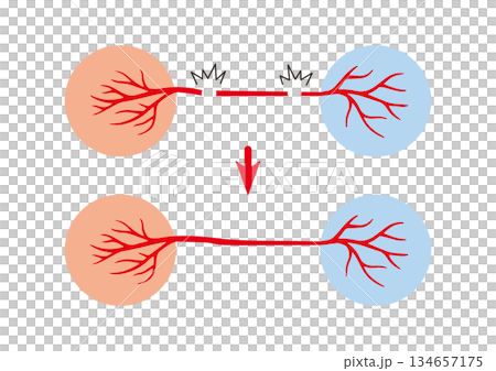 Easy-to-understand neuroregenerative medicine: Nerve regeneration revives nerves; natural healing, self-regeneration, and functional recovery 134657175