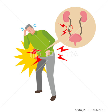 尿路結石で苦しむ男性 134667156