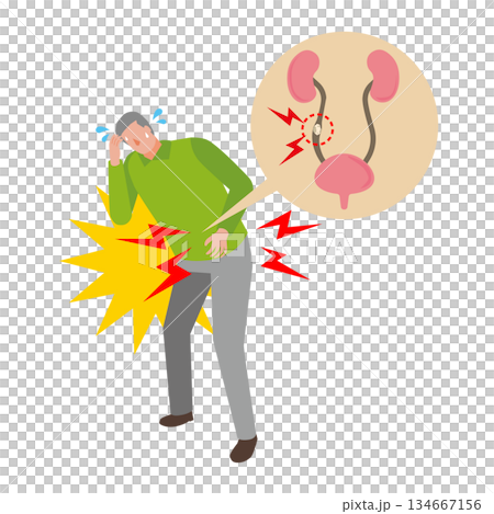 尿路結石で苦しむ男性 134667156