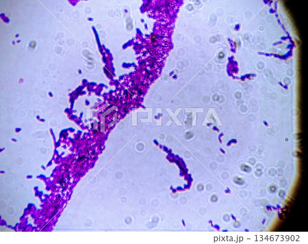 グラム陽性菌の仲間の乳酸菌 134673902
