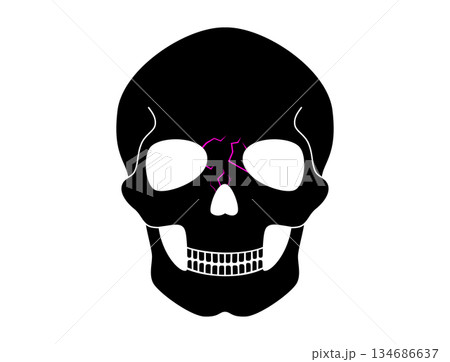 Nasal fracture poster 134686637
