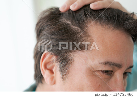 50代男性の生え際のアップ 50代男性の生え際のアップ 134753466