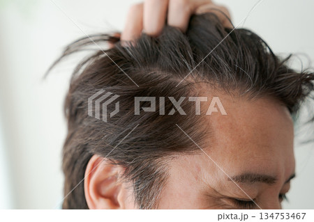 50代男性の生え際のアップ 50代男性の生え際のアップ 134753467