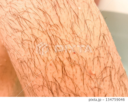 男性の足の毛 134759046
