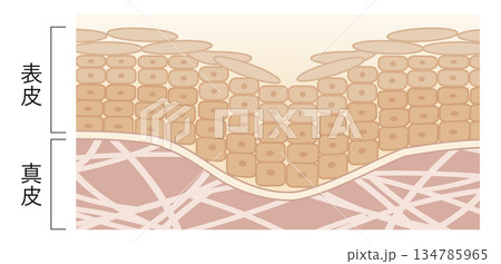 シワができた肌 134785965