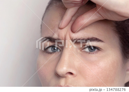 Glabellar lines, folds in a middle-aged woman with blue eyes. Woman dissatisfied with interforehead lines. Copy space Glabellar lines, folds in a middle-aged woman with blue eyes. Woman dissatisfied with interforehead lines. Copy space 134788276