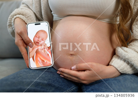 Pregnant woman holds smartphone displaying ultrasound image of fetus next to her belly, showcasing prenatal technology and anticipation 134805936