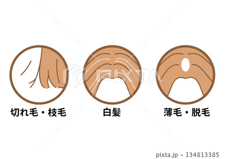 髪の毛　頭皮　悩み例 134813385