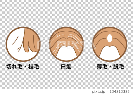 髪の毛　頭皮　悩み例 134813385
