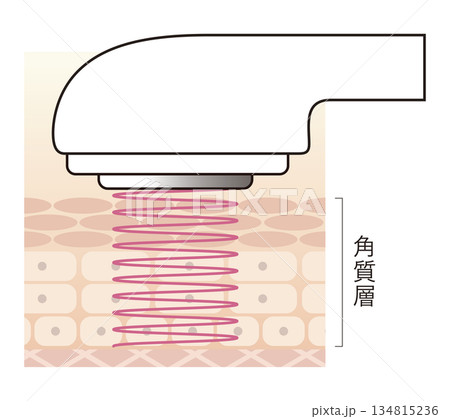 美顔器のキャビテーション 134815236