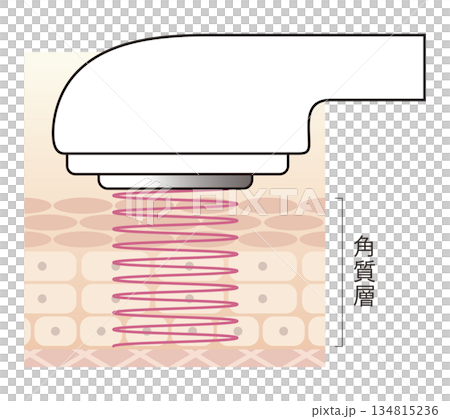 美顔器のキャビテーション 134815236