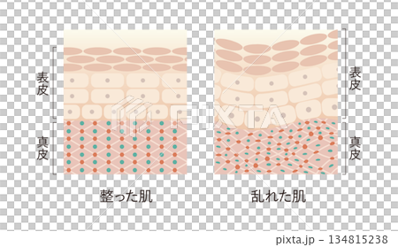 皮膚輪廓分明,但皮膚粗糙。 皮膚輪廓分明,但皮膚粗糙。 134815238