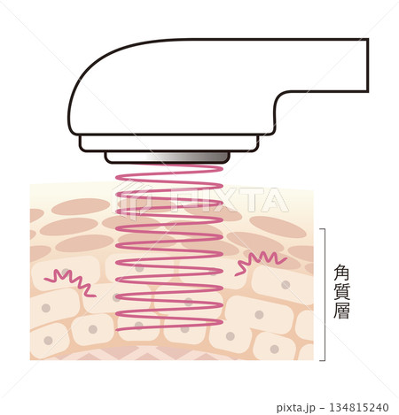 美顔器のキャビテーション 134815240
