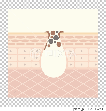 黒ずみ角栓毛穴 134815241