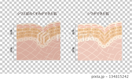 シワとくすみ シワとくすみ 134815242