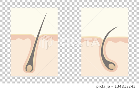 頭髮是如何生長的 134815243