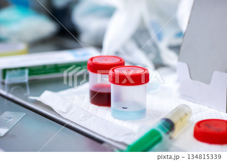 Clinical laboratory scene with sample containers and transfer instruments ready for use Clinical laboratory scene with sample containers and transfer instruments ready for use 134815339