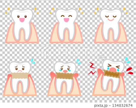 歯周病の歯茎と歯のイラスト素材セット3 134832674