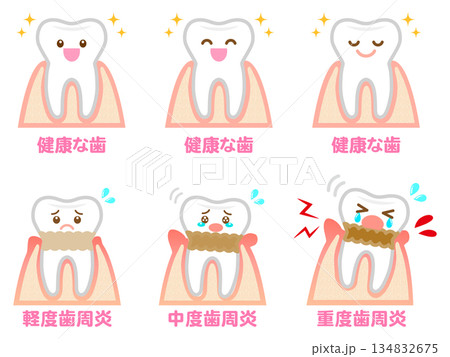 歯周病の歯茎と歯のイラスト素材セット4 134832675