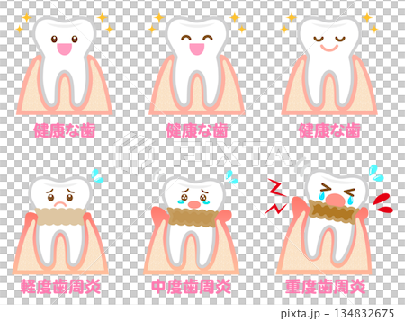 牙周疾病牙齦與牙齒插畫材料集 4 134832675
