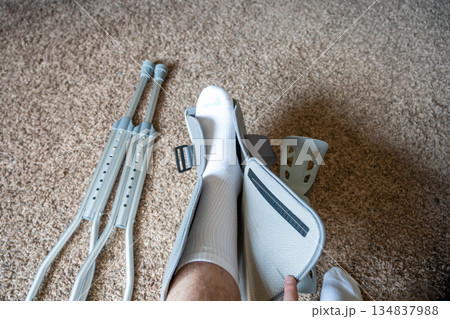 Leg brace and crutches placed on carpet with a foot resting near them during recovery time at home 134837988