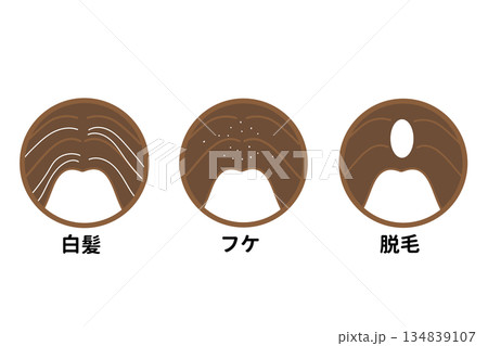 髪の毛 頭皮 悩み例 髪の毛 頭皮 悩み例 134839107