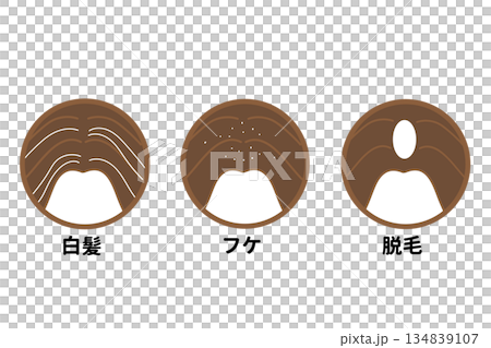 髪の毛 頭皮 悩み例 髪の毛 頭皮 悩み例 134839107