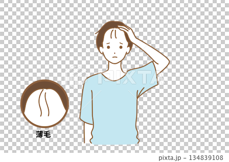 A man who is troubled with thinning hair 134839108