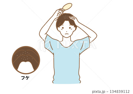フケに悩む男性 134839112
