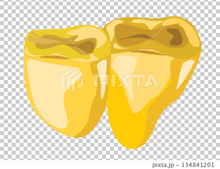 gold tooth illustration gold tooth illustration 134841201