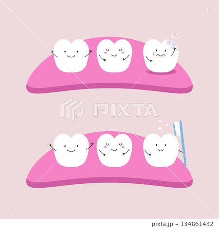 Cute Cartoon Tooth Characters on Gums to Compare Dental Problems. Adorable Vector Illustration 134861432