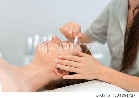 Dermatologist applying cream on the face of a 134861727