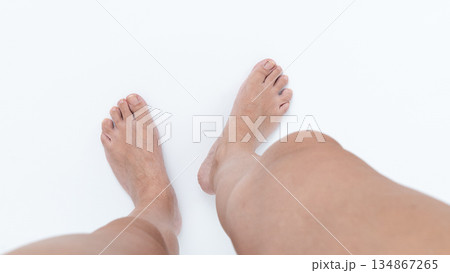 Swelling of legs with visible skin texture and natural tones, highlighting health concerns and body awareness in a minimalistic setting 134867265