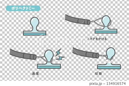 大腸ポリープ切除(ポリペクトミー)の手順・図解イラスト 大腸ポリープ切除(ポリペクトミー)の手順・図解イラスト 134916574