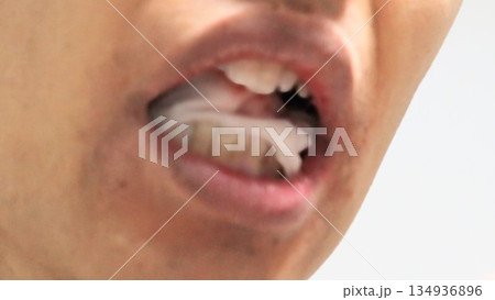 親知らず抜歯後にガーゼを噛む人物 134936896