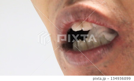 親知らず抜歯後にガーゼを噛む人物 134936899