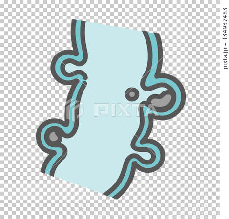 大腸憩室の断面図と便の詰まり（糞石） 134937483
