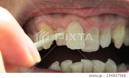 爪楊枝で歯の隙間を掃除する人物 134937568