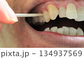 爪楊枝で歯の隙間を掃除する人物 134937569