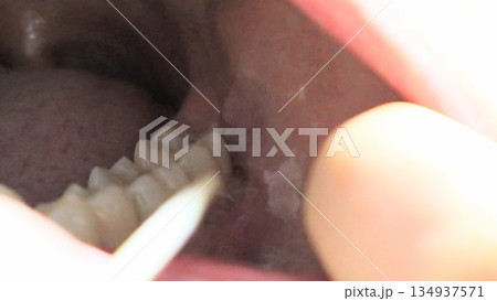 爪楊枝で歯の隙間を掃除する人物 134937571