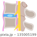 椎間板の構造　腰椎椎間板ヘルニア 135005199