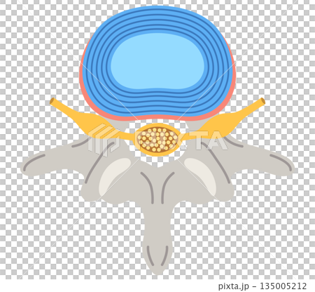 Structure of the intervertebral disc: Lumbar disc herniation 135005212