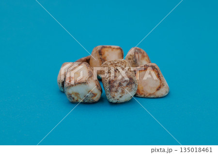 手術で摘出された多数の胆石、青背景 135018461