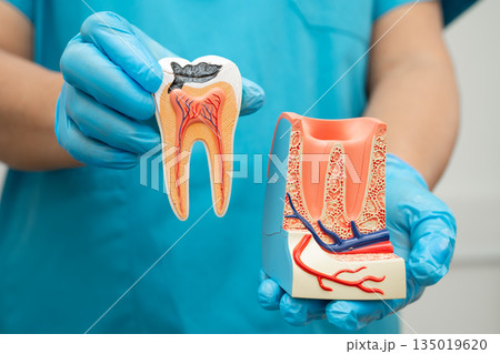 Asian dentist holding dental implant, artificial tooth roots into jaw, root canal of dental treatment, gum disease, teeth model for dentist. Asian dentist holding dental implant, artificial tooth roots into jaw, root canal of dental treatment, gum disease, teeth model for dentist. 135019620