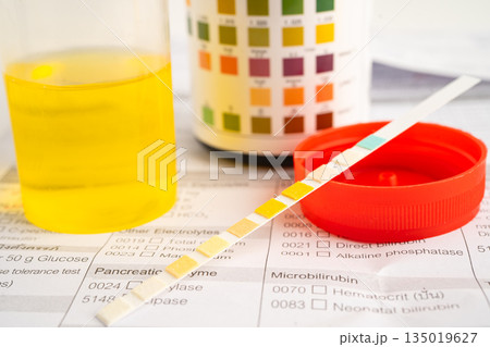 Urinalysis, urine cup with reagent strip pH paper test and comparison chart in laboratory. 135019627