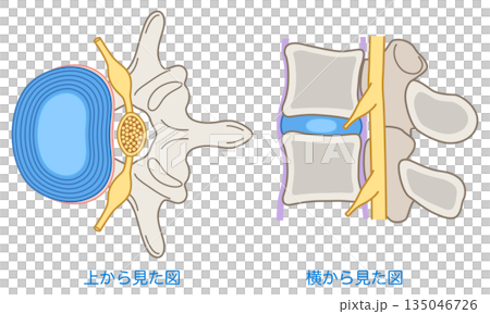 Structure of the lumbar disc: Lumbar disc herniation Structure of the lumbar disc: Lumbar disc herniation 135046726