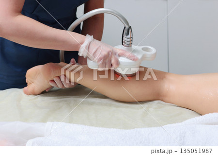 Hardware massage. Anti-cellulite massage of the shin area. The posterior surface of the shin. Body care. The procedure at the beauty salon. Non-surgical figure correction. 135051987