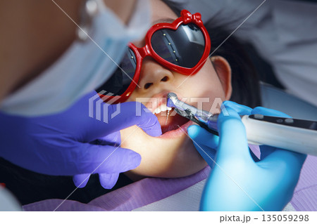 Child Undergoes Dental Filling Procedure for Caries in Modern Dentist Office 135059298