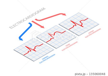 3D Isometric Flat  Illustration of Electrocardiogram, Diagnostics and Healthcare 135060048